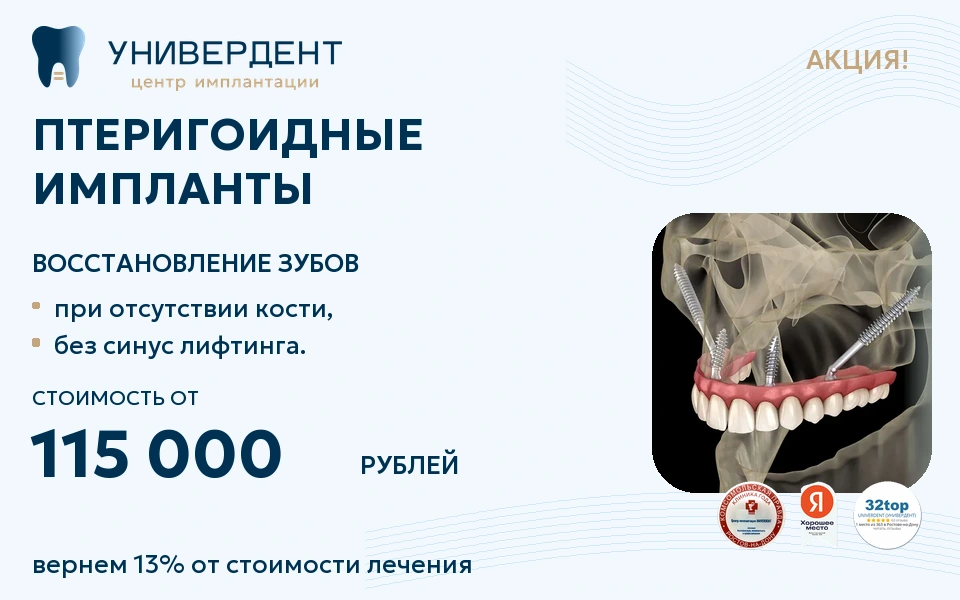 Акция: Установка птеригоидных имплантов