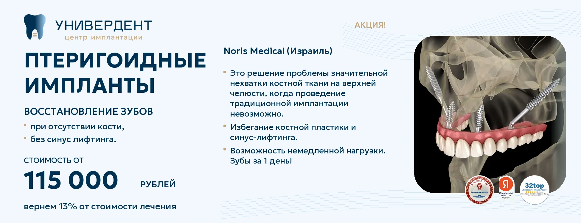 Птеригоидные