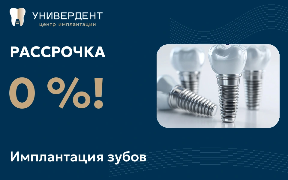 Имплантация зубов