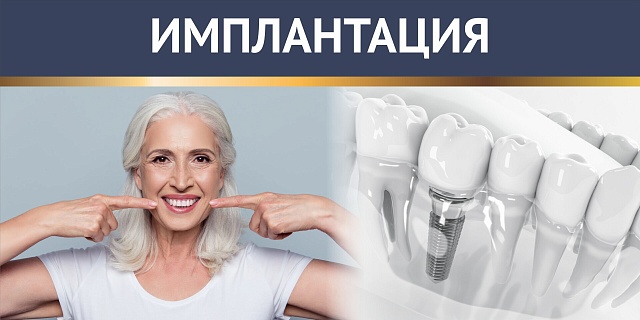 Виды систем имплантации
