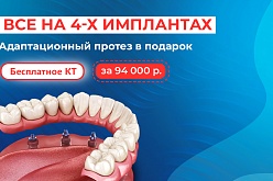 «Всё на 4»: имплантация "под ключ" и съёмный адаптационный протез!