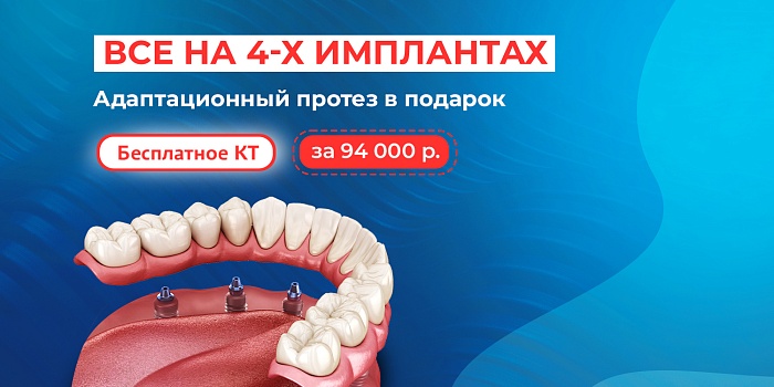 «Всё на 4»: имплантация "под ключ" и съёмный адаптационный протез!