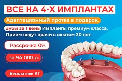 «Всё на 4»: имплантация "под ключ" и съёмный адаптационный протез!