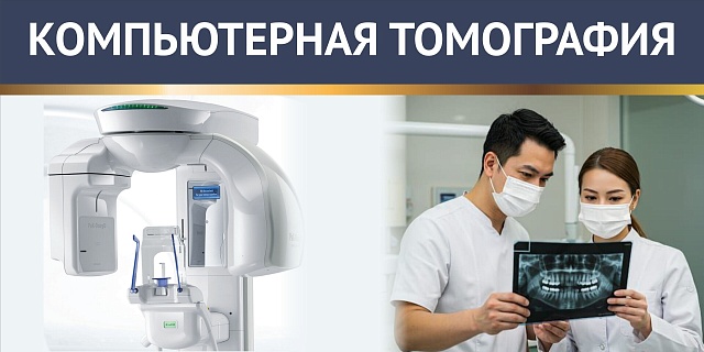 Компьютерная томография