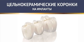 Цельнокерамические коронки